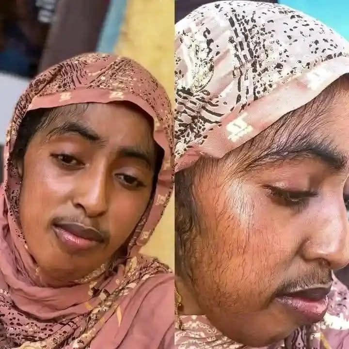 مأساة شابة .. تواجه ظاهرة غريبة وتطلق نداء عاجلا