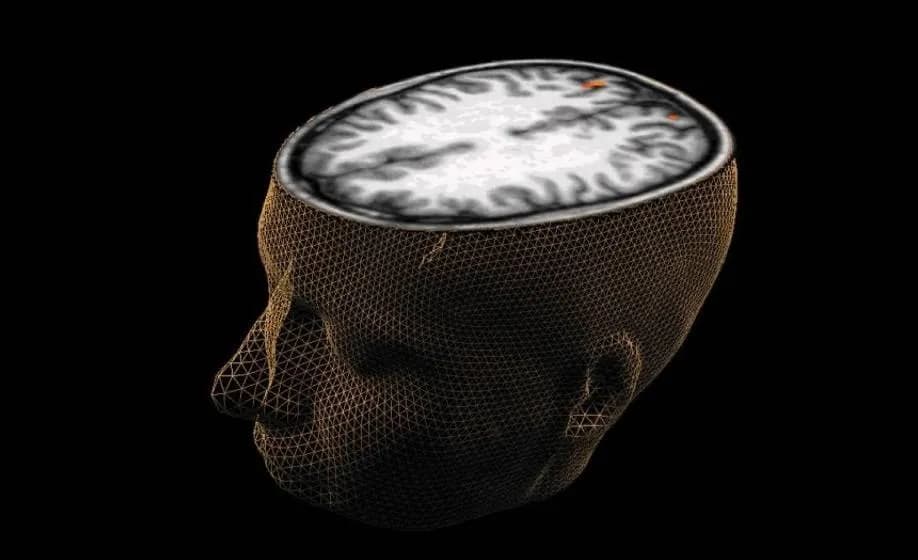 باحثون يكتشفون مؤشرا حيويا قد يسهم في تحسين علاج الفصام