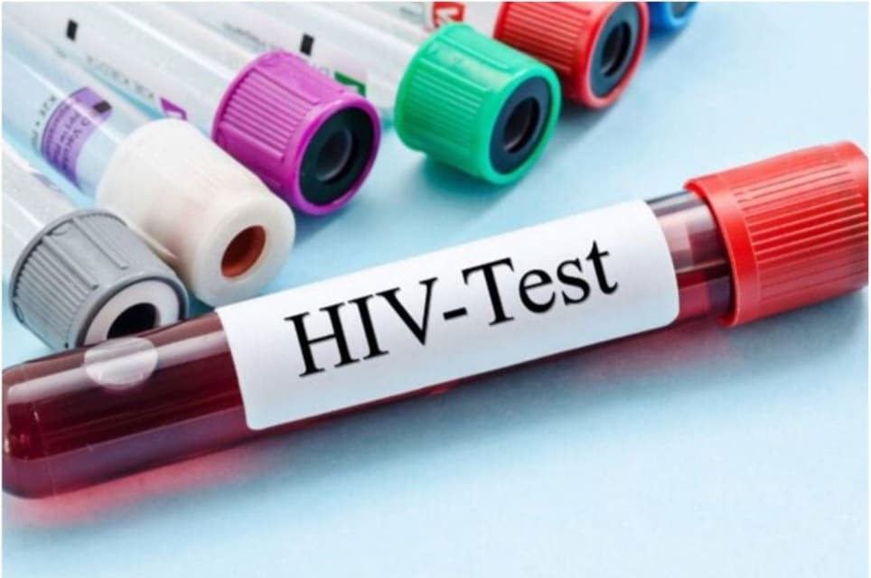 أوغندا تسجل 100 إصابة جديدة بفيروس نقص المناعة يومياً وتحذيرات من استمرار تفشي الوباء