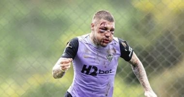 ليانكو يعود لمران أتلتيكو مينيرو بوجه بدون ملامح بعد خناقة الديربى.. صور