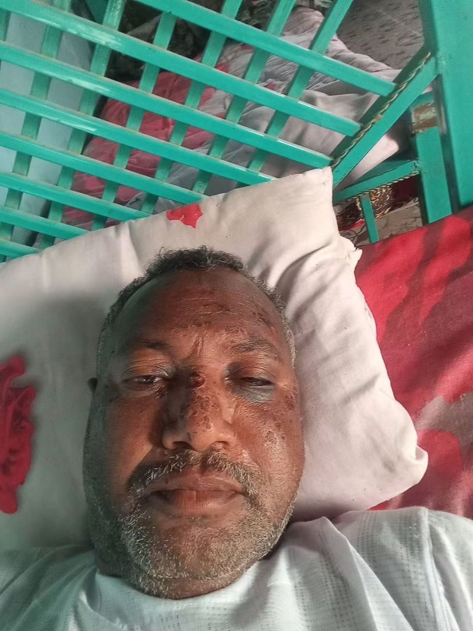 نجاة منشد الإسلاميين أبو القاسم العوض من الموت ويحكي قصة عمك دا مات  