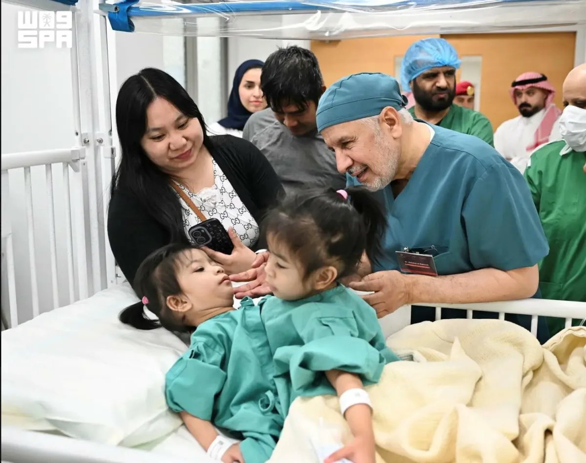 بدء عملية فصل التوأم الفلبيني الملتصق أوليفيا وجيانا في الرياض