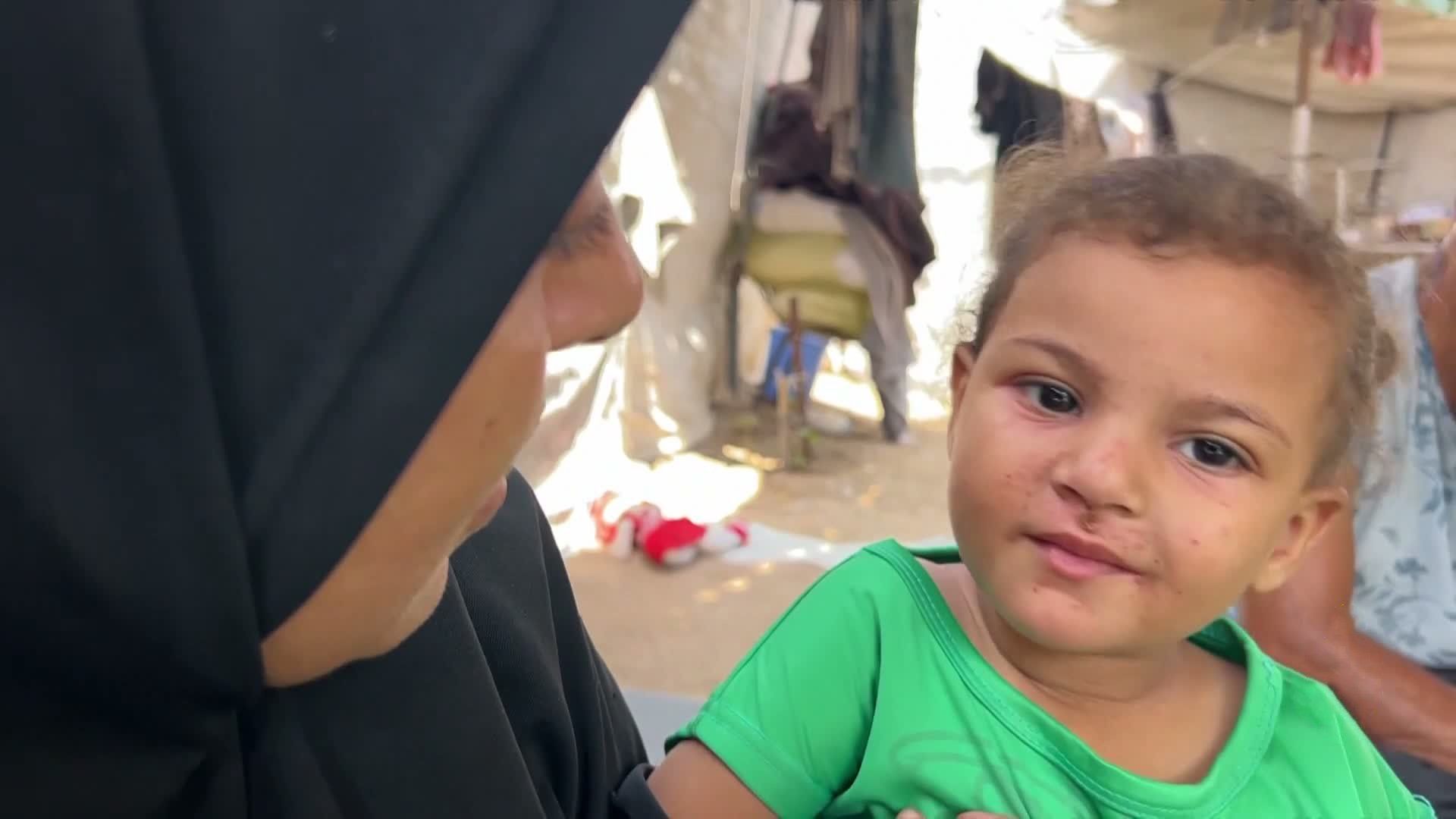 68 مليون طن من الركام في غزة.. خطر صحي وبيئي يلاحق السكان